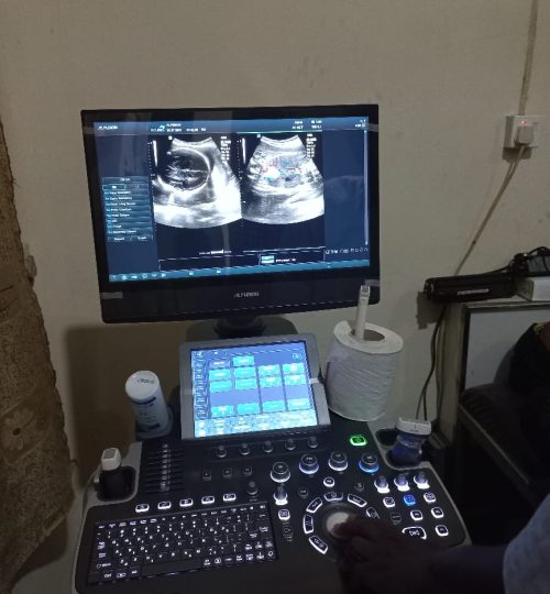 m-med ultrasound machine