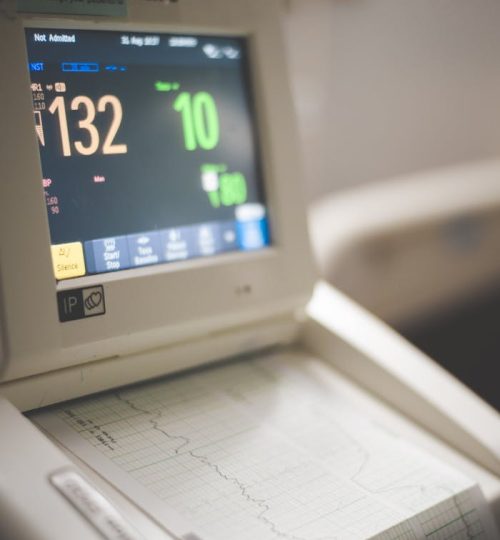 Shallow Focus of Electrocardiogram